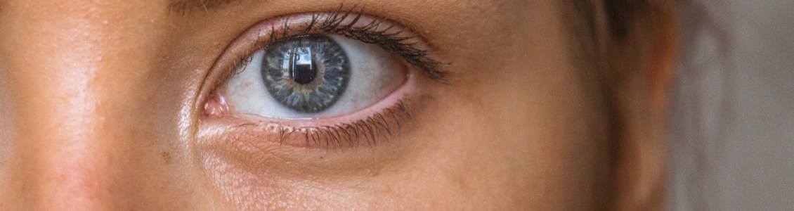 What are the Symptoms of Dry Eye?