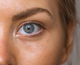 What are the Symptoms of Dry Eye?